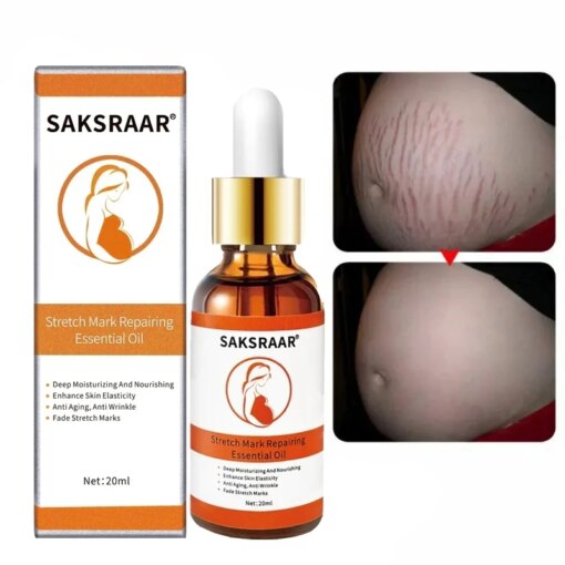Stretch Marks Remover Essential Oil Skin Care Treatment Cream For Stretch Mark Removal Maternity Slackline For Pregnant Oils